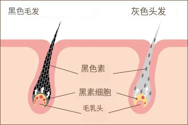 除了染发 头发白了还能变黑吗：医生给的答案出乎意料 头发白了还能变黑吗 第1张