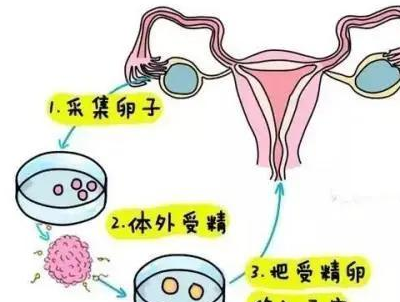 孕前检查没问题，为什么备孕多年就是怀不上呢？  孕前检查 第4张