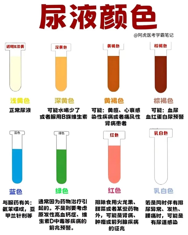 早晨第一泡尿 可能是身体在“喊救命”！这些信号千万小心 第2张