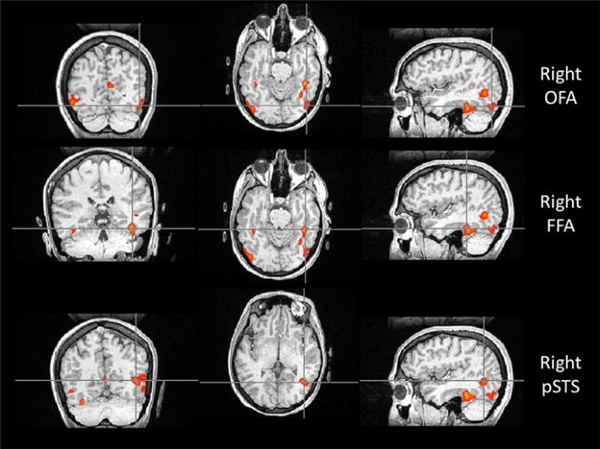 一个人能记住多少个人的脸 这个数字赌你猜不到 第1张 一个人能记住多少个人的脸 这个数字赌你猜不到 第1张